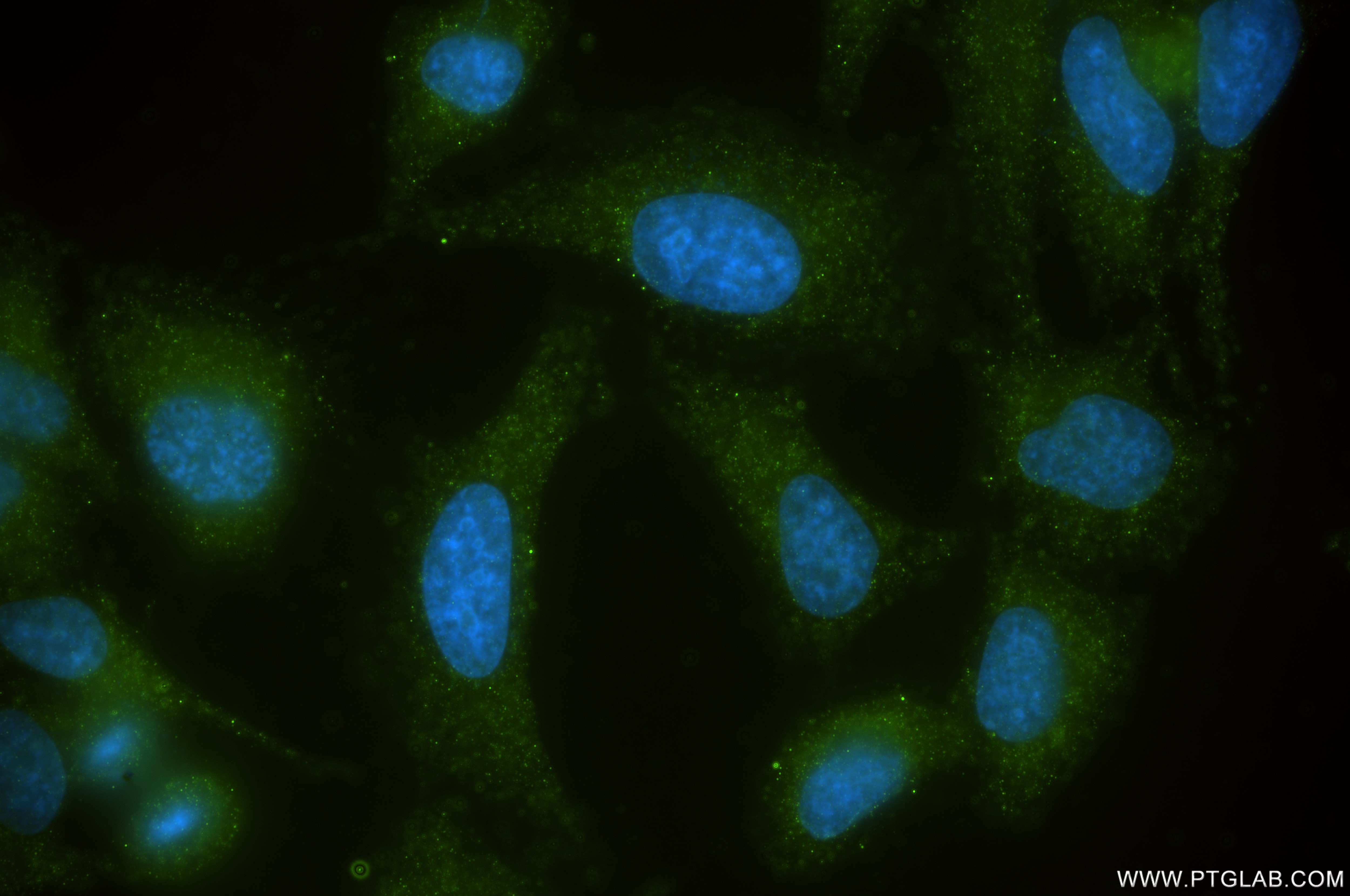 Immunofluorescence (IF) / fluorescent staining of HepG2 cells using FTL Recombinant antibody (81166-3-RR)