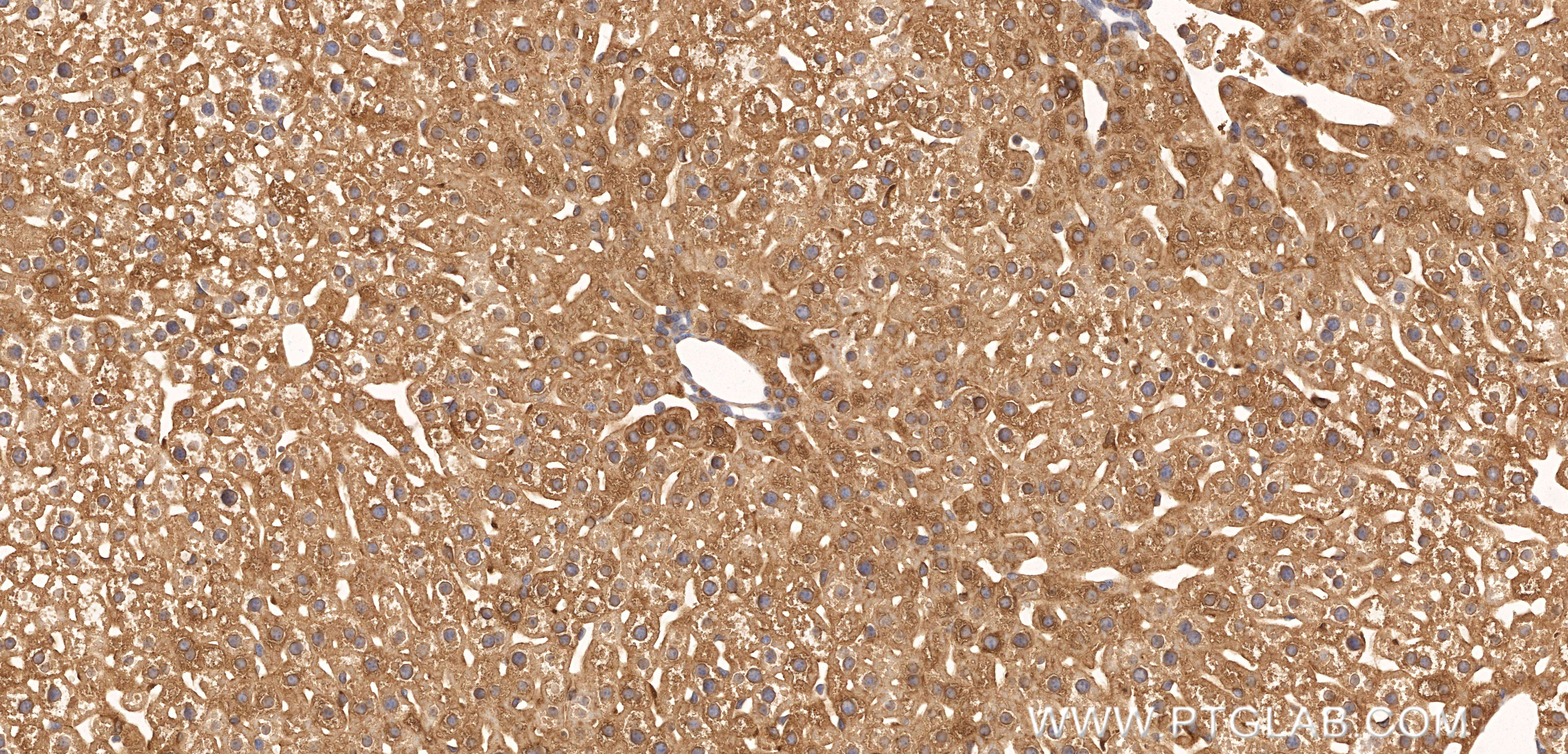 Immunohistochemistry (IHC) staining of mouse liver tissue using FTL Recombinant monoclonal antibody (81166-3-RR)