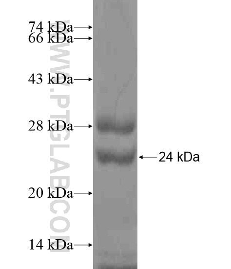FTL fusion protein Ag20637 SDS-PAGE