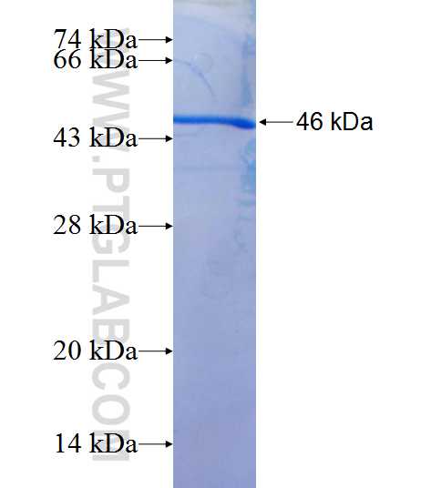 FTL fusion protein Ag1149 SDS-PAGE