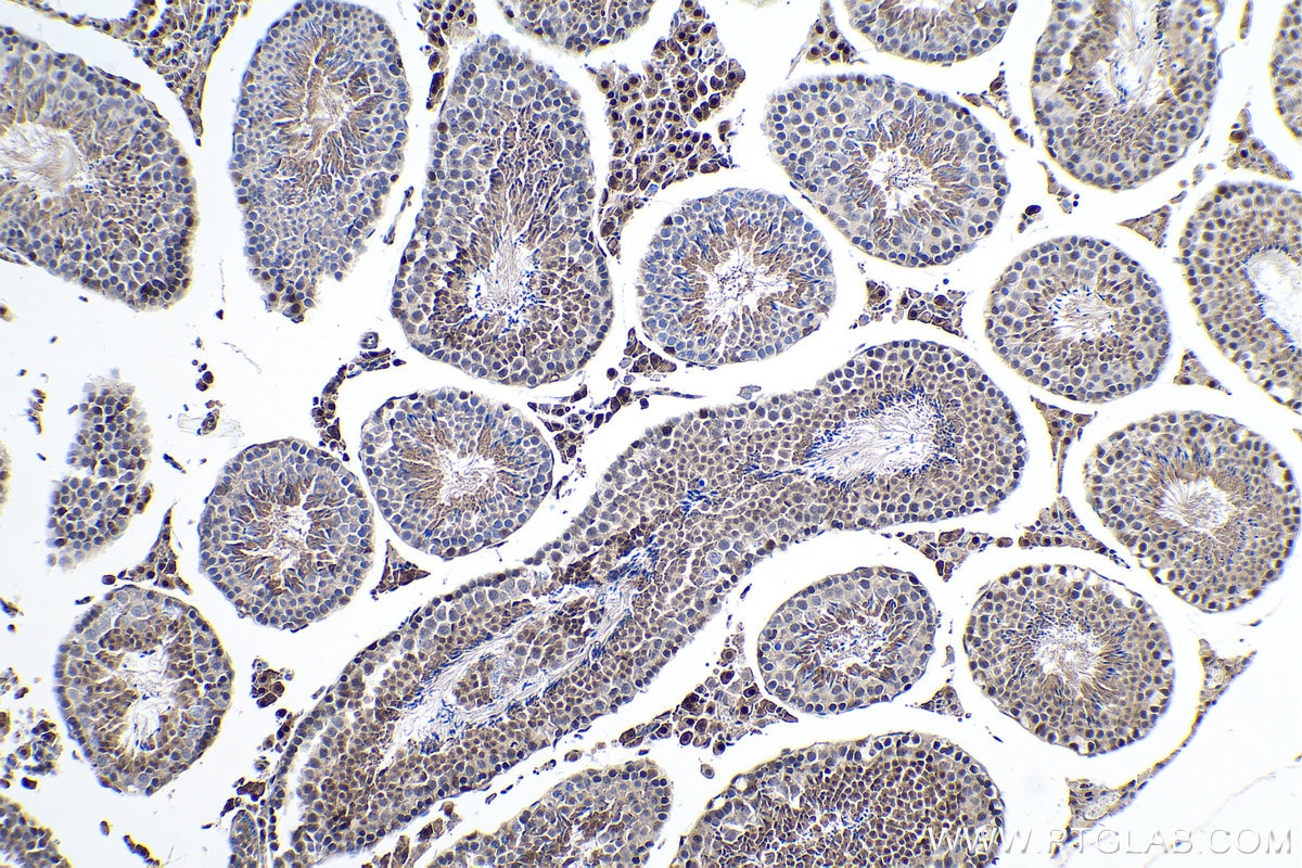 Immunohistochemistry (IHC) staining of mouse testis tissue using FTO Polyclonal antibody (27226-1-AP)