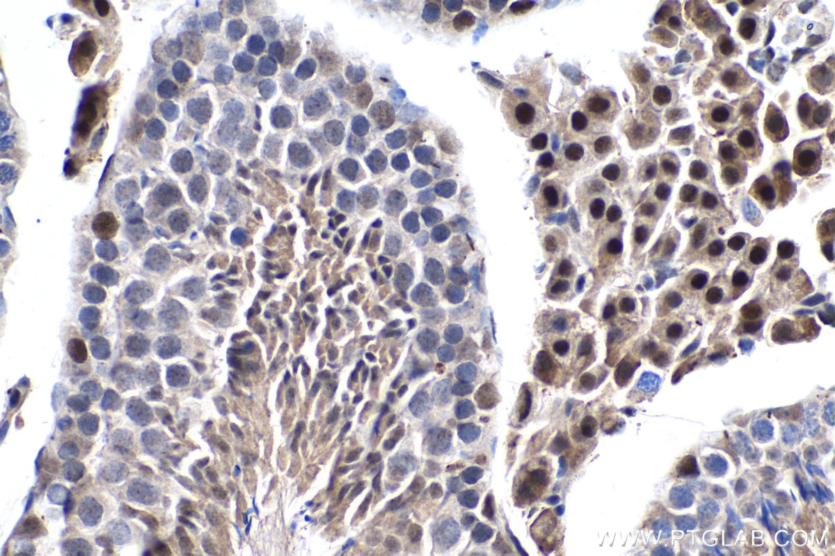 Immunohistochemistry (IHC) staining of mouse testis tissue using FTO Polyclonal antibody (27226-1-AP)