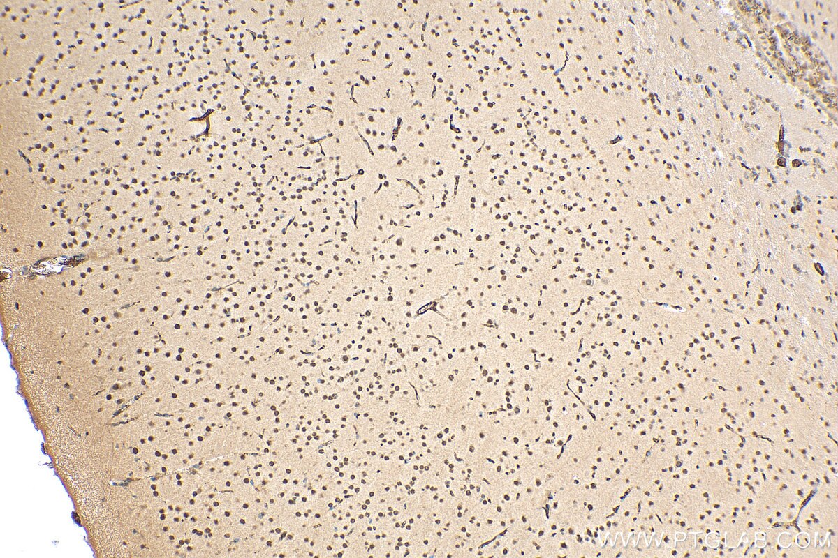 IHC staining of mouse brain using 27226-1-AP
