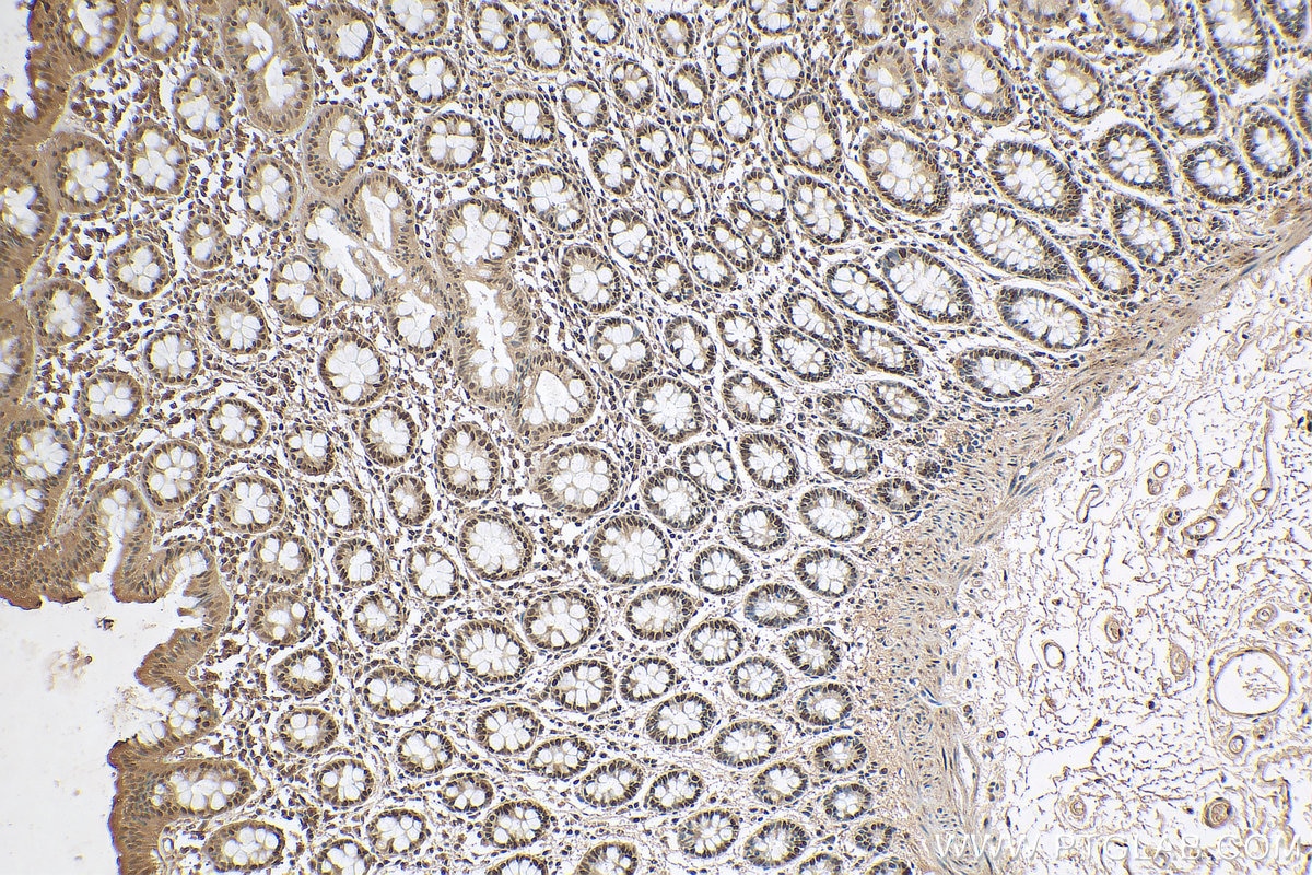 Immunohistochemistry (IHC) staining of human colon tissue using FTO Polyclonal antibody (27226-1-AP)
