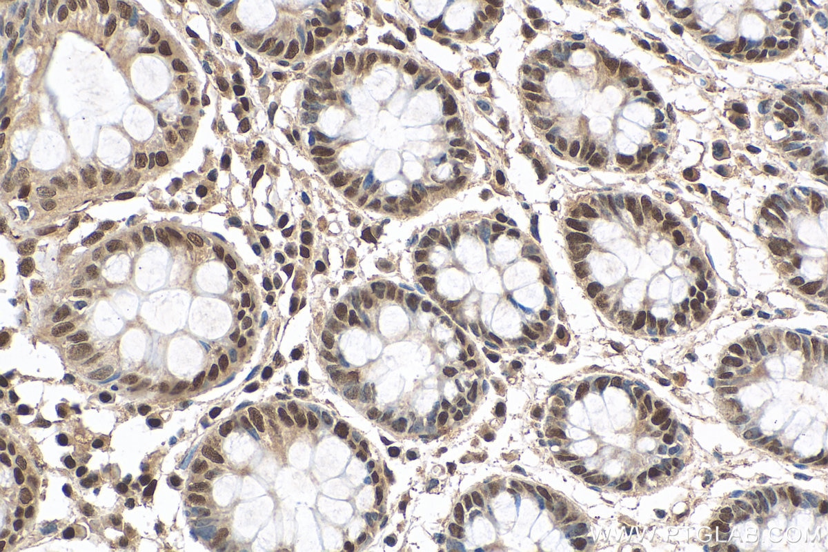 Immunohistochemistry (IHC) staining of human colon tissue using FTO Polyclonal antibody (27226-1-AP)