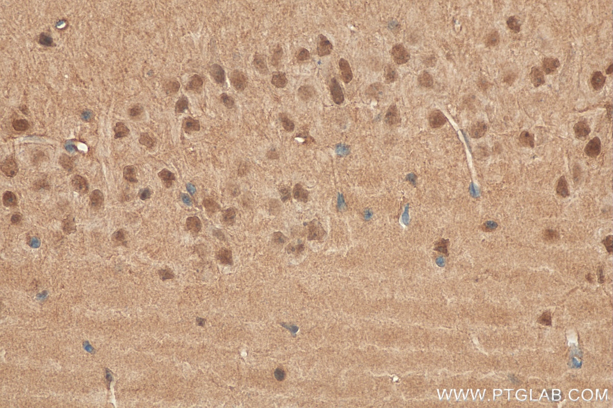 Immunohistochemistry (IHC) staining of mouse brain tissue using FTO Polyclonal antibody (27226-1-AP)