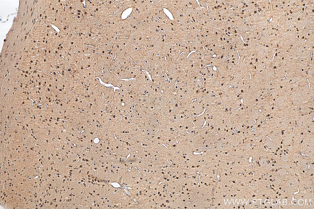 Immunohistochemistry (IHC) staining of mouse brain tissue using FTO Polyclonal antibody (27226-1-AP)