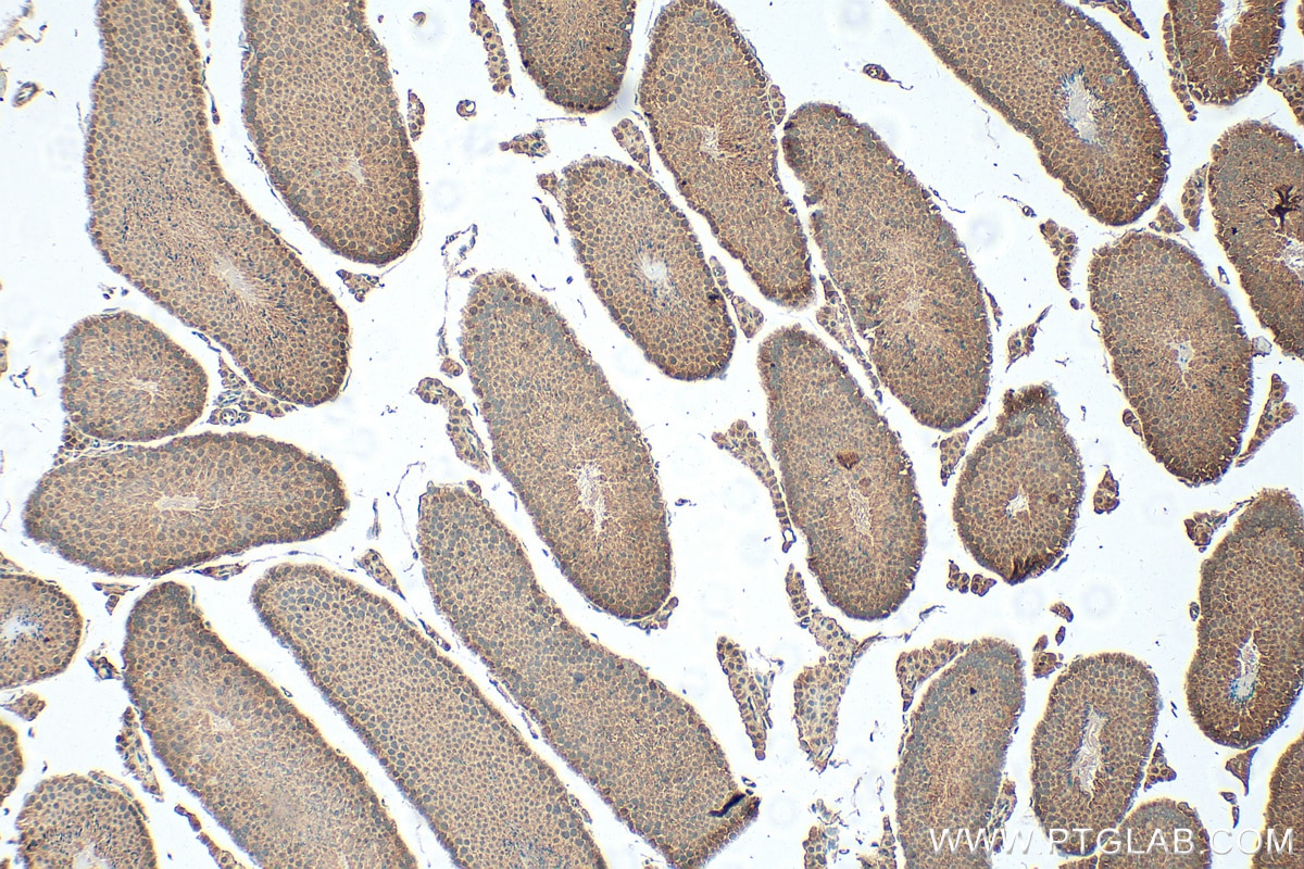 Immunohistochemistry (IHC) staining of mouse testis tissue using FTO Polyclonal antibody (27226-1-AP)