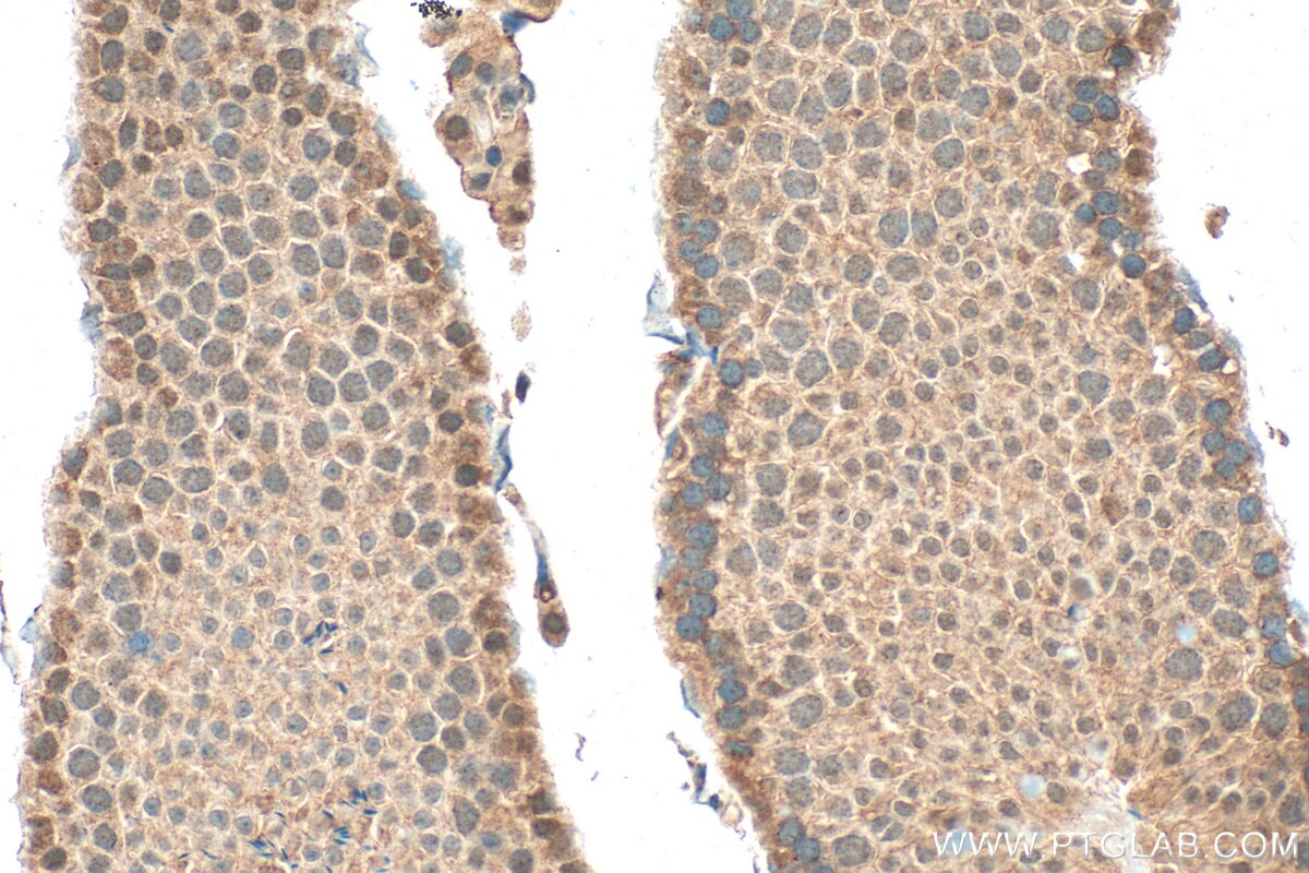 Immunohistochemistry (IHC) staining of mouse testis tissue using FTO Polyclonal antibody (27226-1-AP)