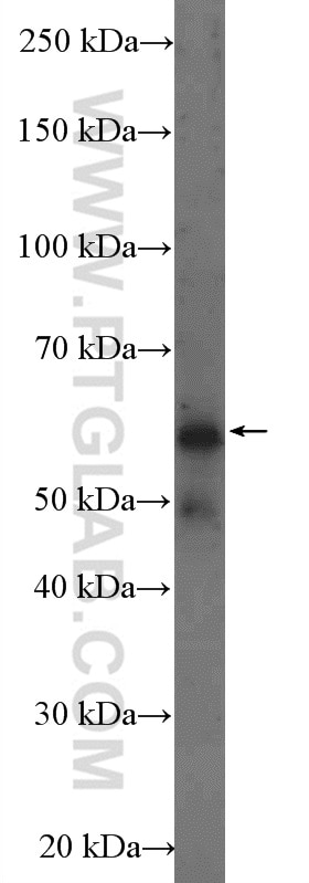 FTO Polyclonal antibody