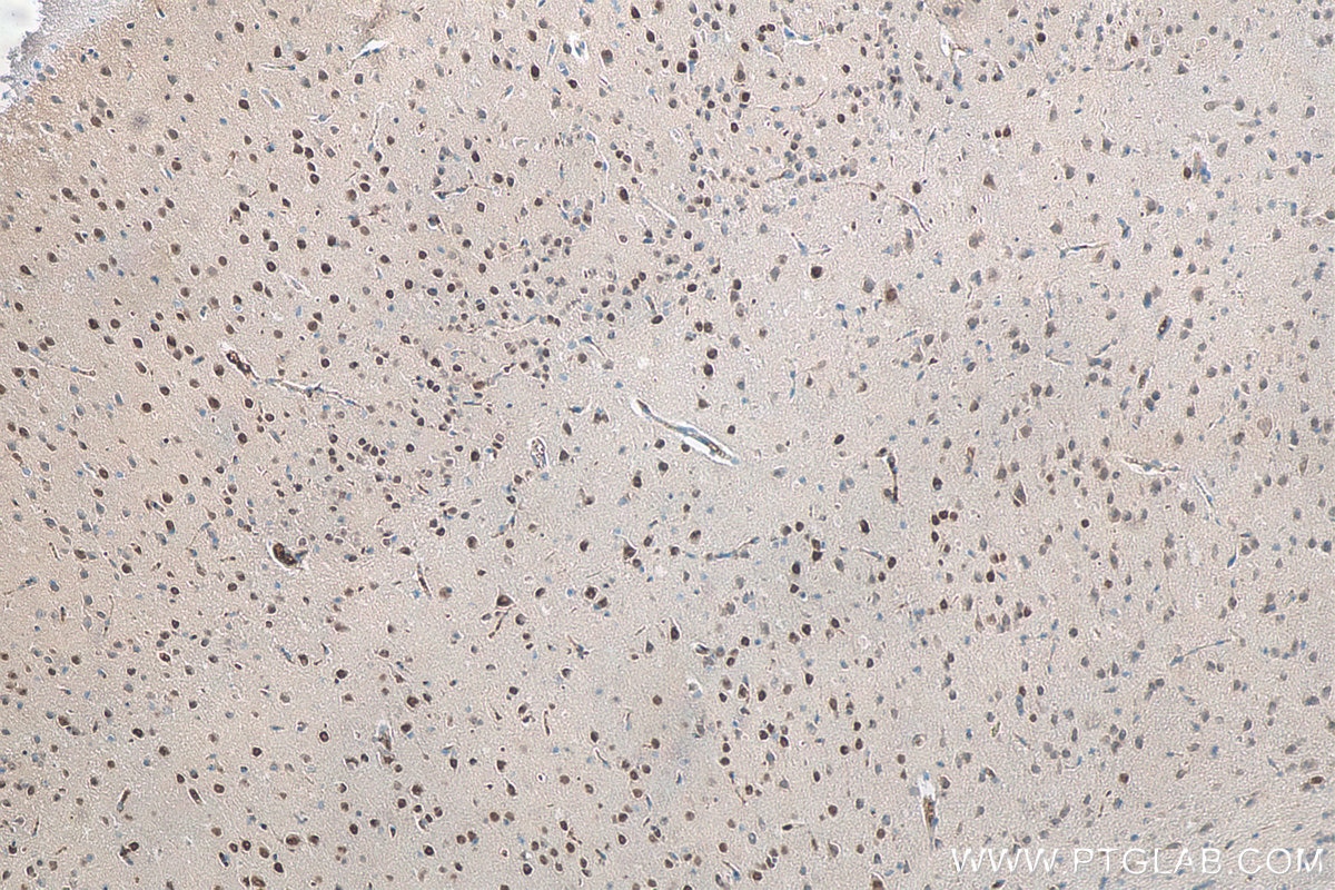 Immunohistochemistry (IHC) staining of mouse brain tissue using FTO Monoclonal antibody (68111-1-Ig)