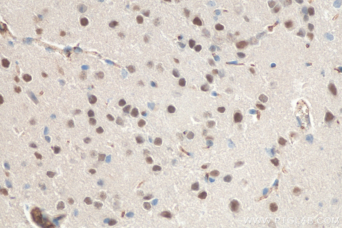 Immunohistochemistry (IHC) staining of mouse brain tissue using FTO Monoclonal antibody (68111-1-Ig)