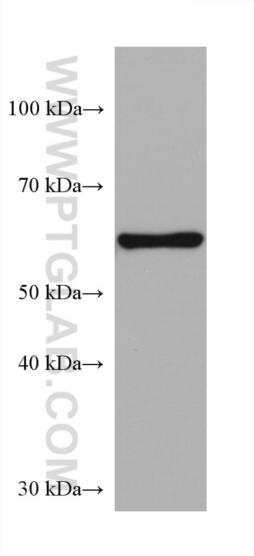 Western Blot (WB) analysis of pig brain tissue using FTO Monoclonal antibody (68111-1-Ig)