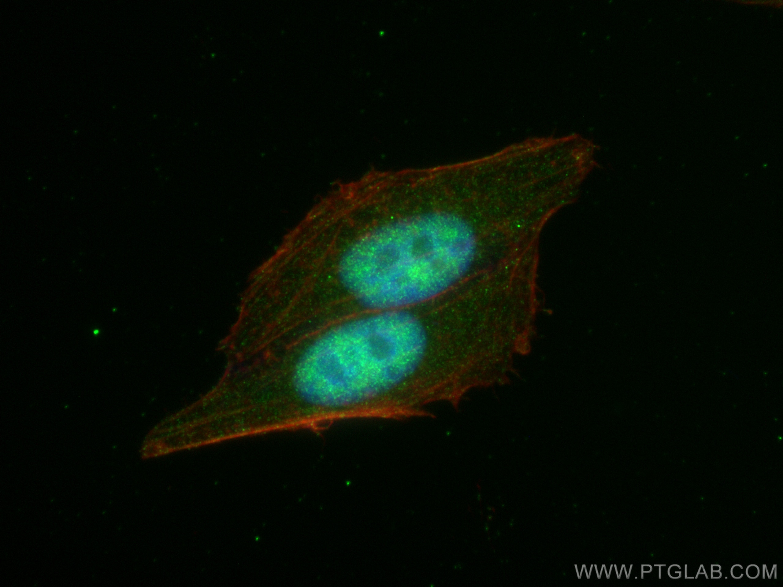 IF Staining of HepG2 using 81471-1-RR