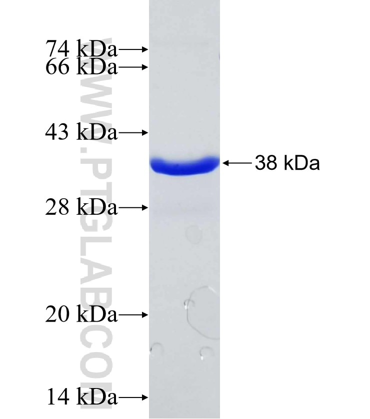 FTO fusion protein Ag26095 SDS-PAGE