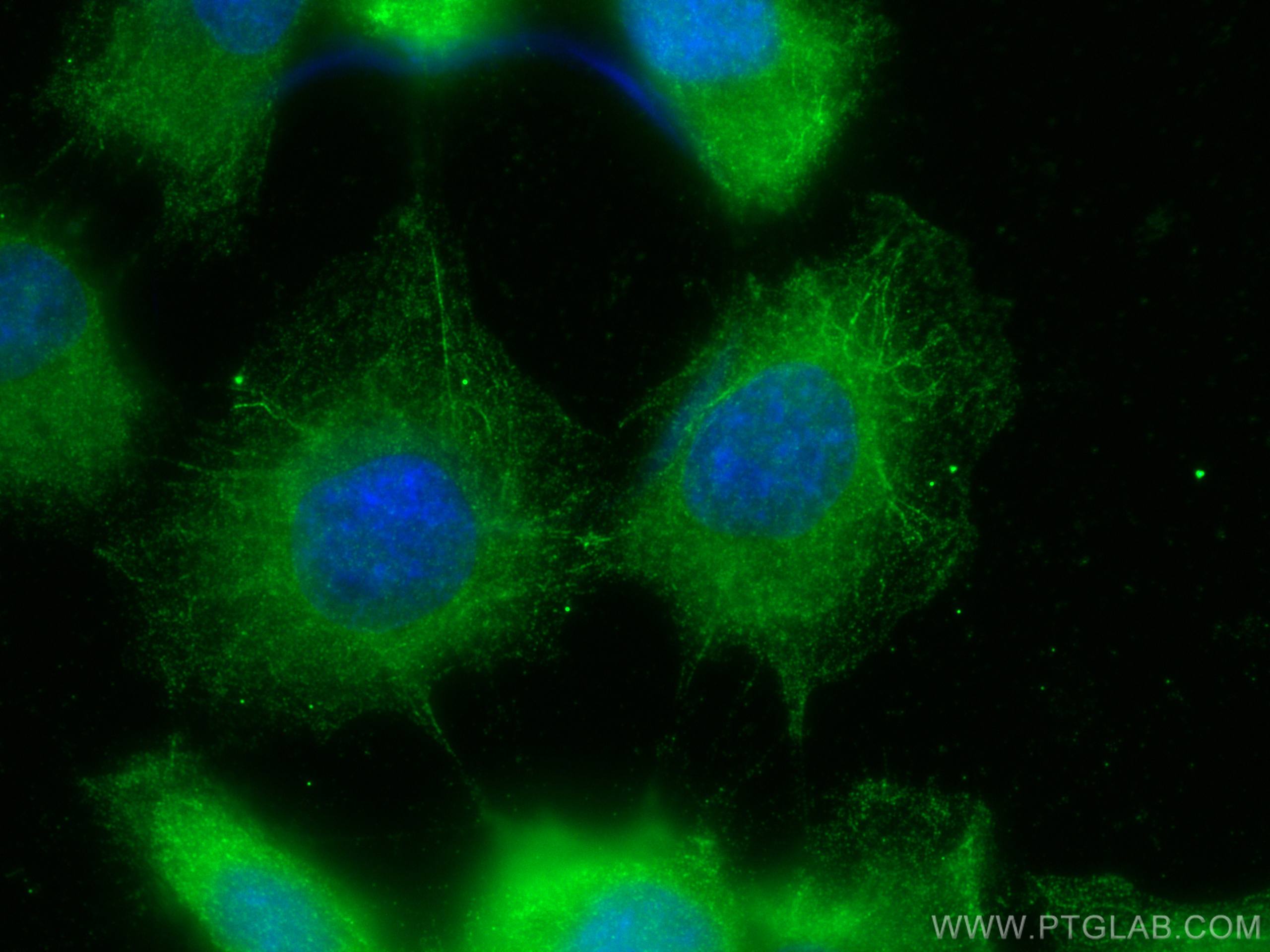 Immunofluorescence (IF) / fluorescent staining of A431 cells using FTSJ1 Polyclonal antibody (11620-1-AP)