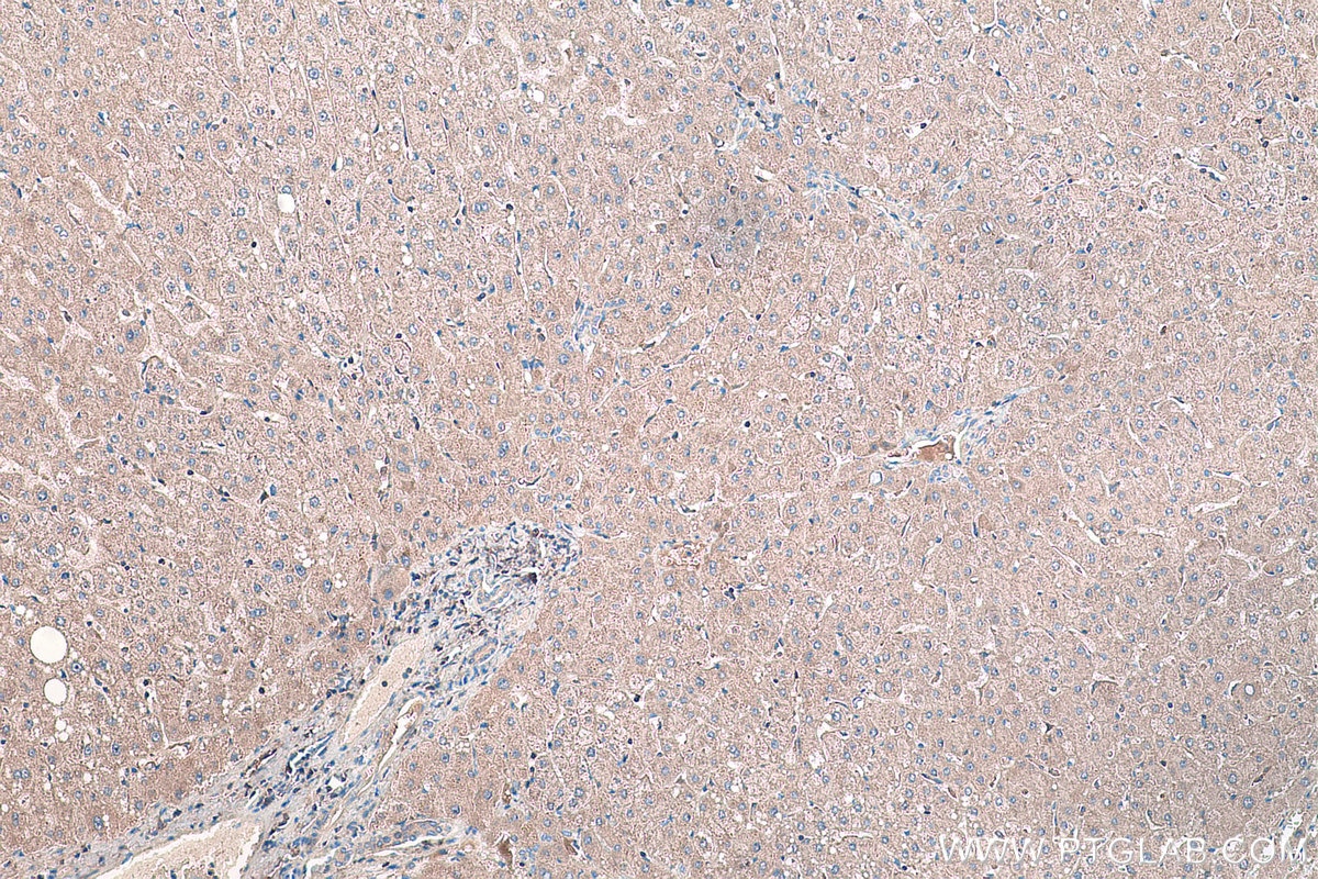 IHC staining of human liver using 11620-1-AP