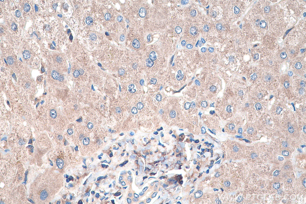 Immunohistochemistry (IHC) staining of human liver tissue using FTSJ1 Polyclonal antibody (11620-1-AP)