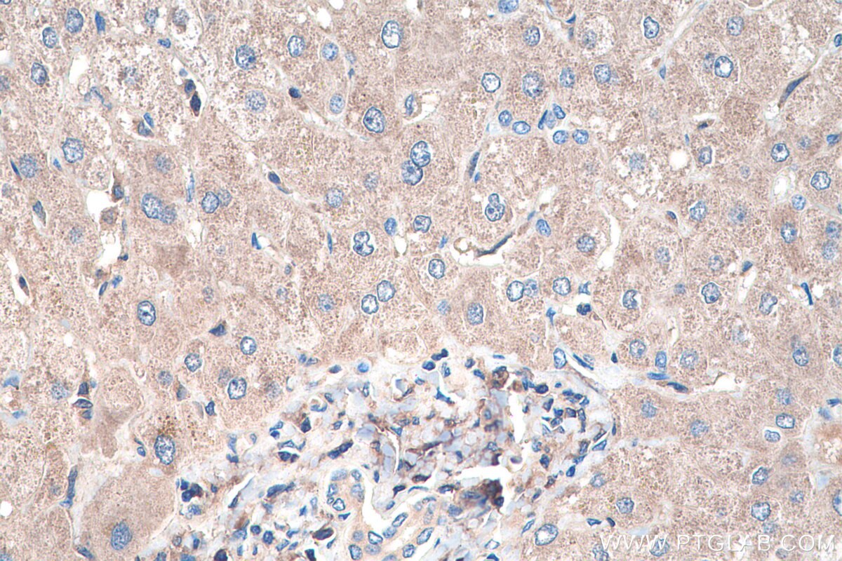 Immunohistochemistry (IHC) staining of human liver tissue using FTSJ1 Polyclonal antibody (11620-1-AP)