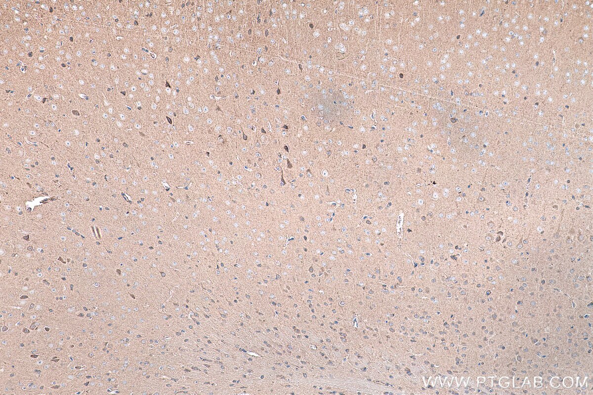 Immunohistochemistry (IHC) staining of mouse brain tissue using FTSJ1 Polyclonal antibody (11620-1-AP)