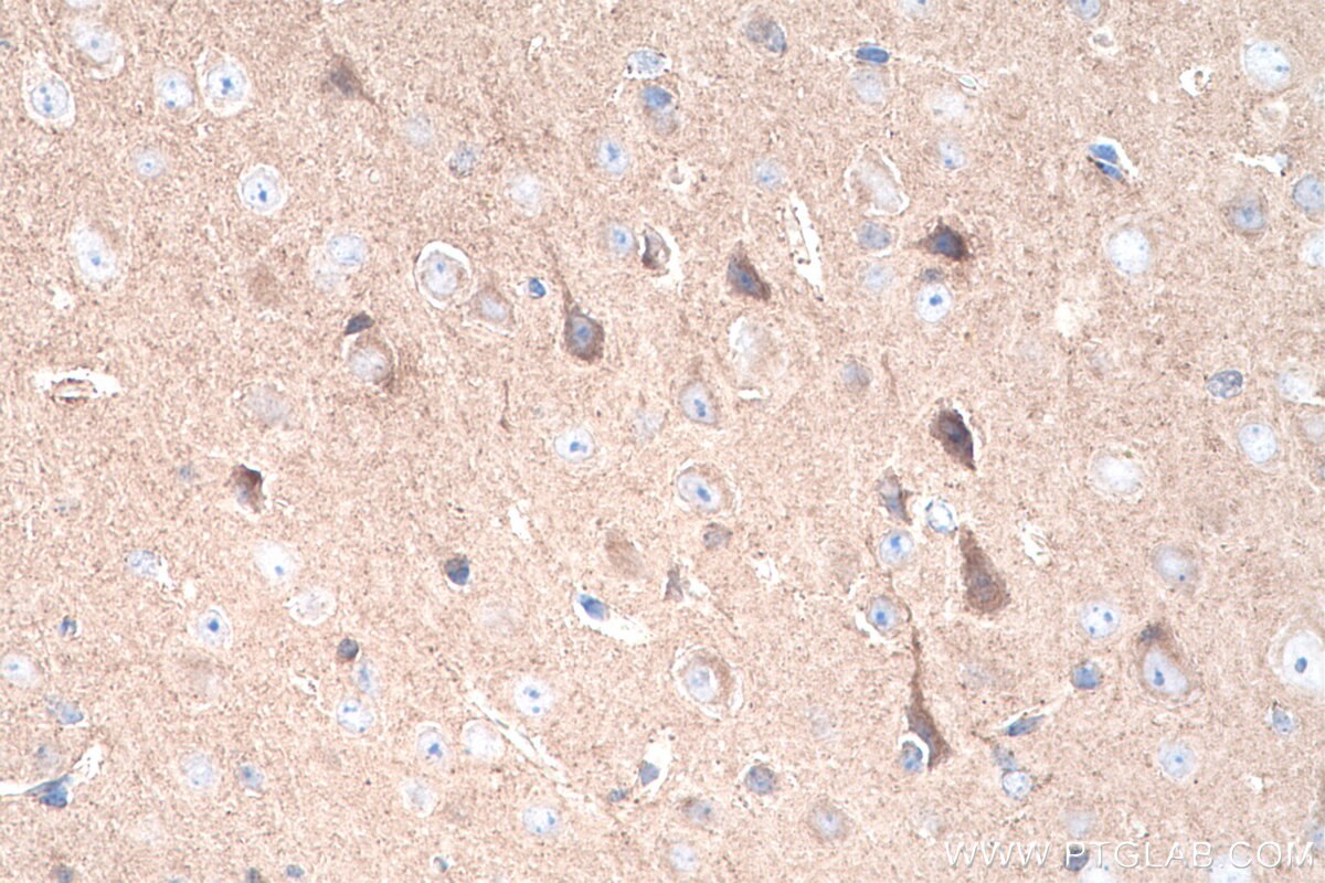 Immunohistochemistry (IHC) staining of mouse brain tissue using FTSJ1 Polyclonal antibody (11620-1-AP)
