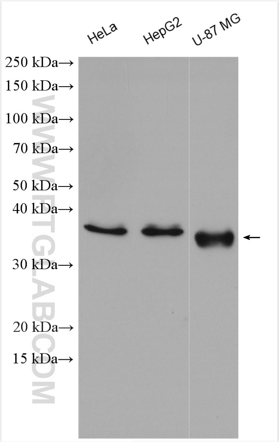 Western Blot (WB) analysis of HeLa cells using FTSJ1 Polyclonal antibody (11620-1-AP)