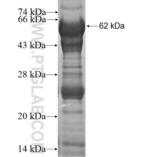 FTSJ1 fusion protein Ag2199 SDS-PAGE