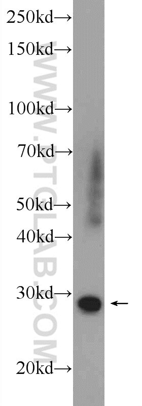 Western Blot (WB) analysis of human placenta tissue using FTSJ2 Polyclonal antibody (22556-1-AP)