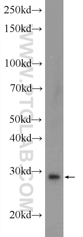 WB analysis of human placenta using 22556-1-AP