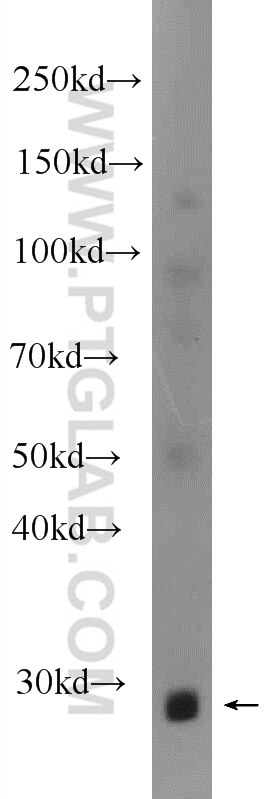 Western Blot (WB) analysis of human skeletal muscle tissue using FTSJ2 Polyclonal antibody (22556-1-AP)