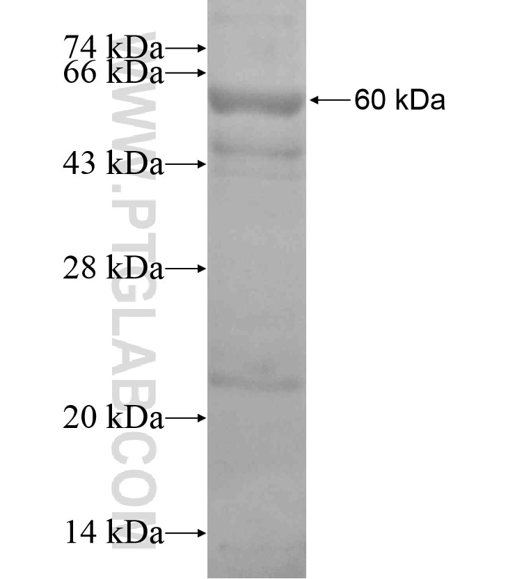 FTSJ2 fusion protein Ag18410 SDS-PAGE