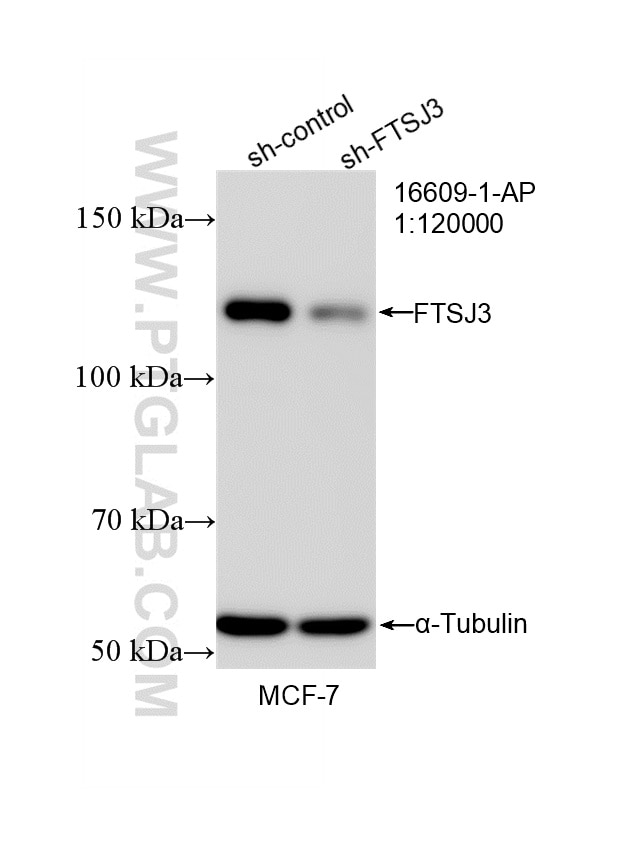 WB result of FTSJ3 antibody (16609-1-AP; 1:120000; incubated at room temperature for 1.5 hours) with sh-Control and sh-FTSJ3 transfected MCF-7 cells. Western Blot (WB) analysis of MCF-7 cells using FTSJ3 Polyclonal antibody (16609-1-AP)