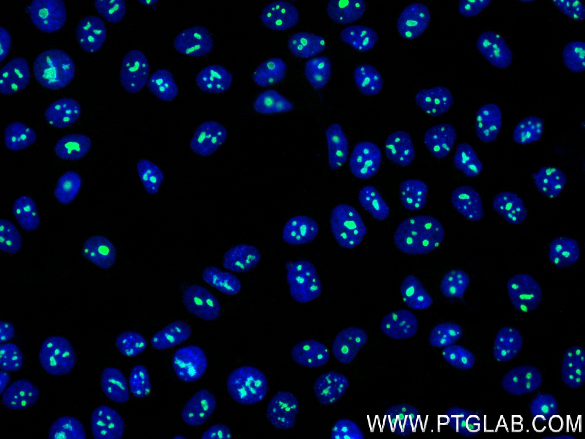Immunofluorescence (IF) / fluorescent staining of MCF-7 cells using FTSJ3 Recombinant antibody (84311-6-RR)
