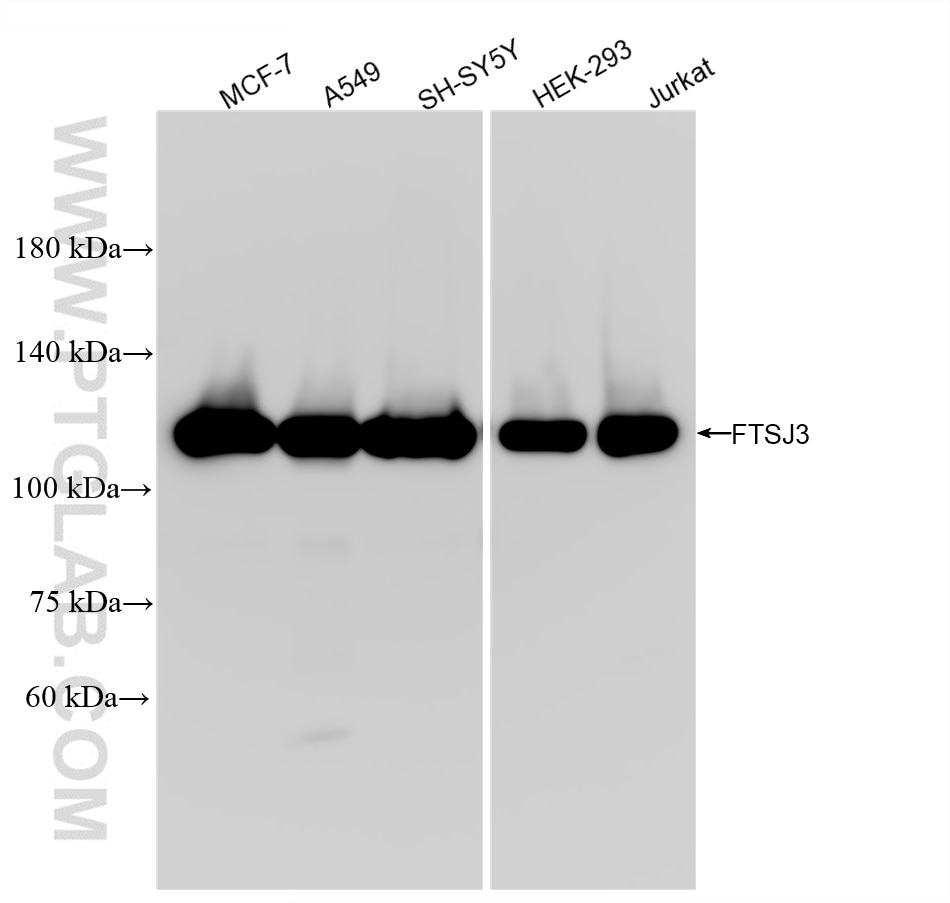 Western Blot (WB) analysis of various lysates using FTSJ3 Recombinant antibody (84311-6-RR)