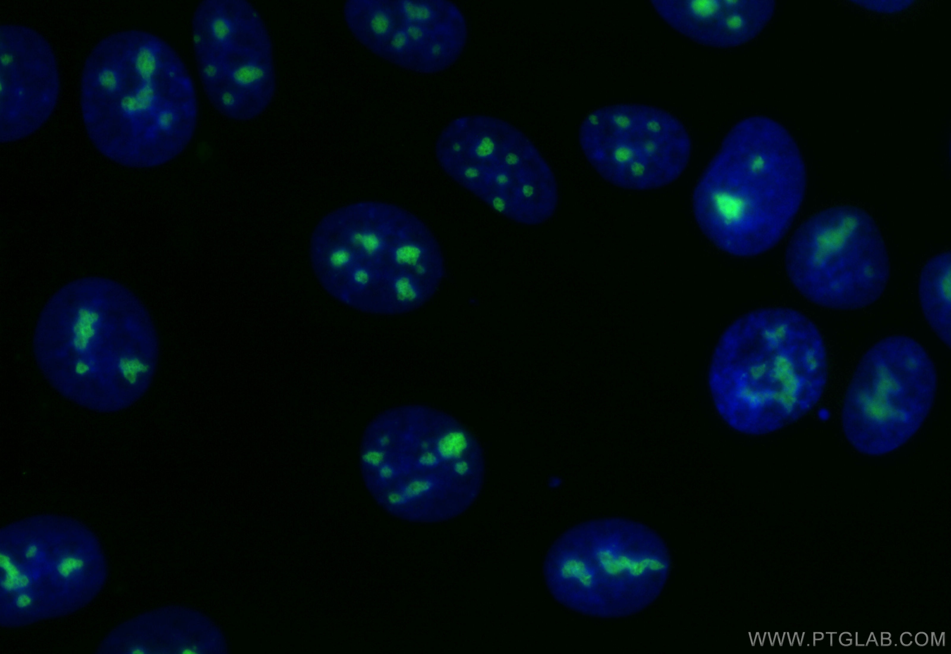Immunofluorescence (IF) / fluorescent staining of MCF-7 cells using CoraLite® Plus 488-conjugated FTSJ3 Recombinant an (CL488-84311-6)