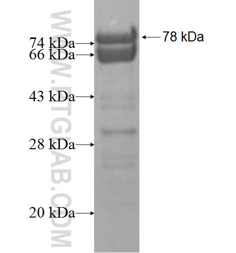 FTSJ3 fusion protein Ag9835 SDS-PAGE