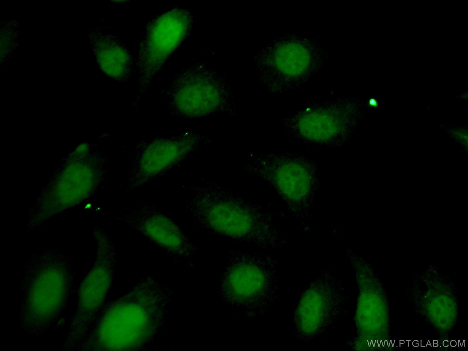 Immunofluorescence (IF) / fluorescent staining of U2OS cells using FTSJD2 Polyclonal antibody (27707-1-AP)