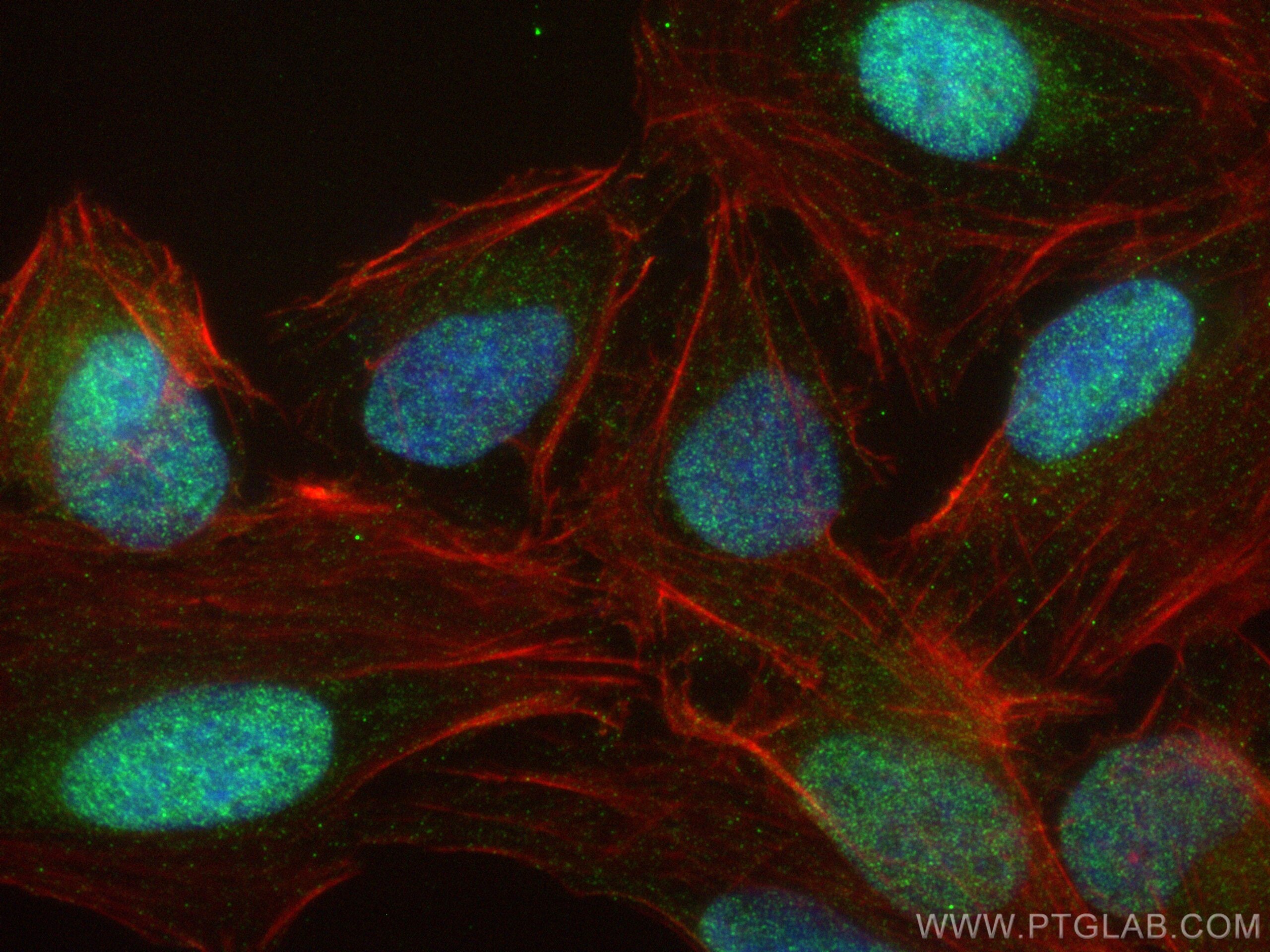 Immunofluorescence (IF) / fluorescent staining of U2OS cells using FTSJD2 Polyclonal antibody (27707-1-AP)