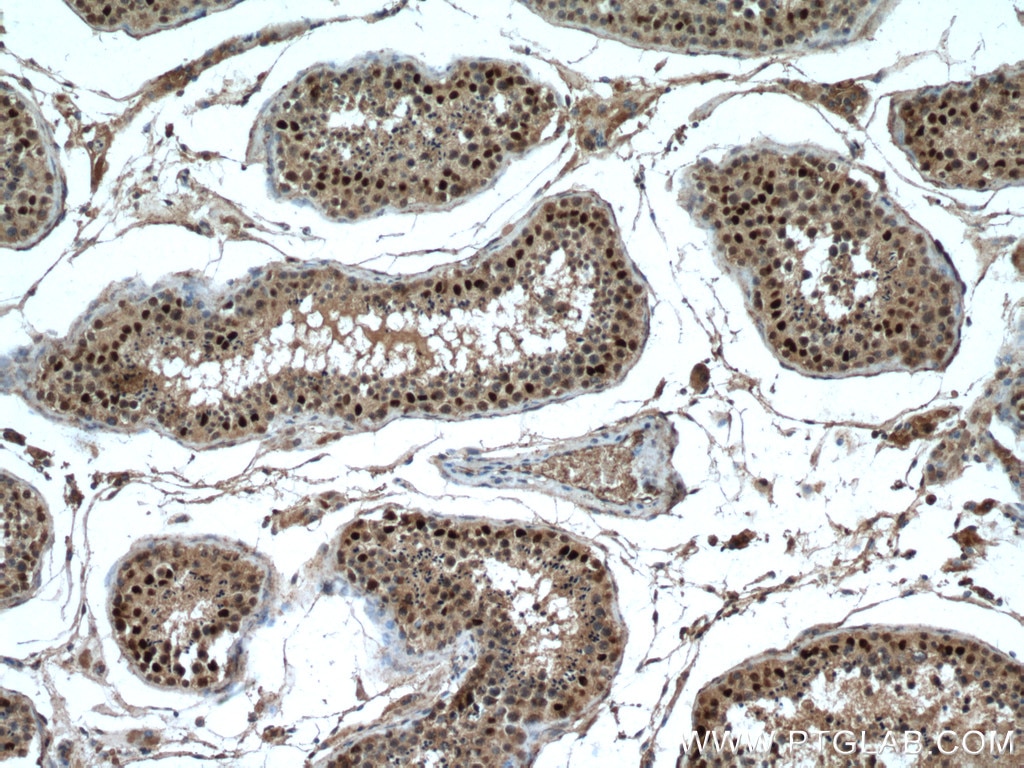 Immunohistochemistry (IHC) staining of human testis tissue using FTSJD2 Polyclonal antibody (27707-1-AP)