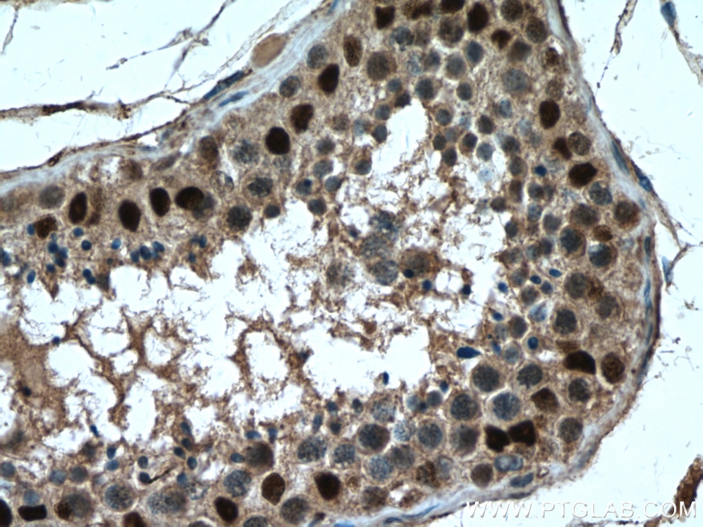 IHC staining of human testis using 27707-1-AP