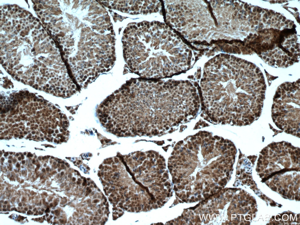 Immunohistochemistry (IHC) staining of mouse testis tissue using FTSJD2 Polyclonal antibody (27707-1-AP)