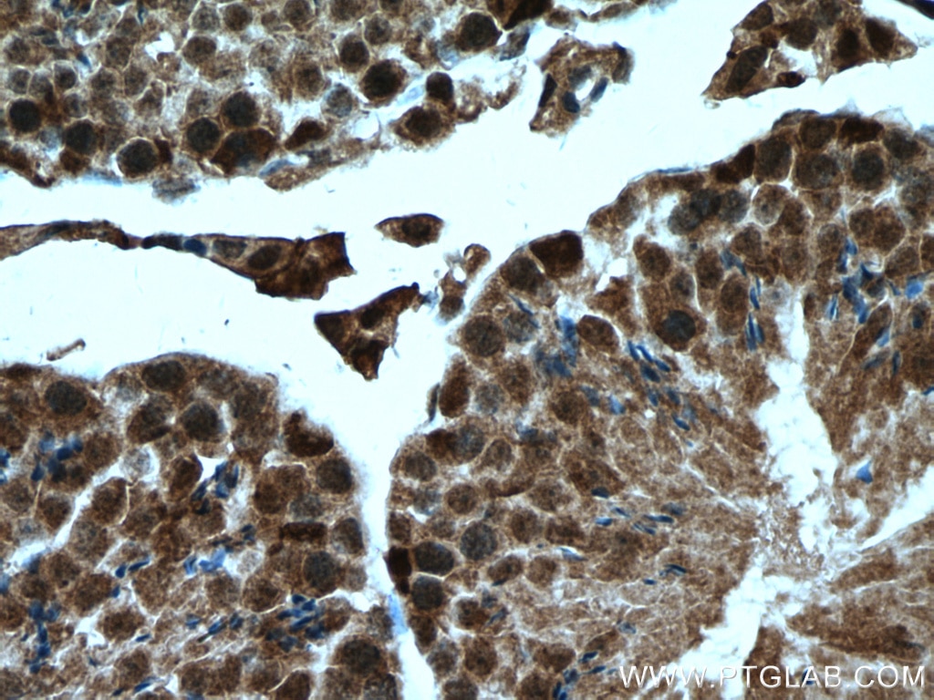 Immunohistochemistry (IHC) staining of mouse testis tissue using FTSJD2 Polyclonal antibody (27707-1-AP)