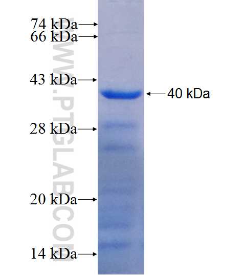 FTSJD2 fusion protein Ag26722 SDS-PAGE