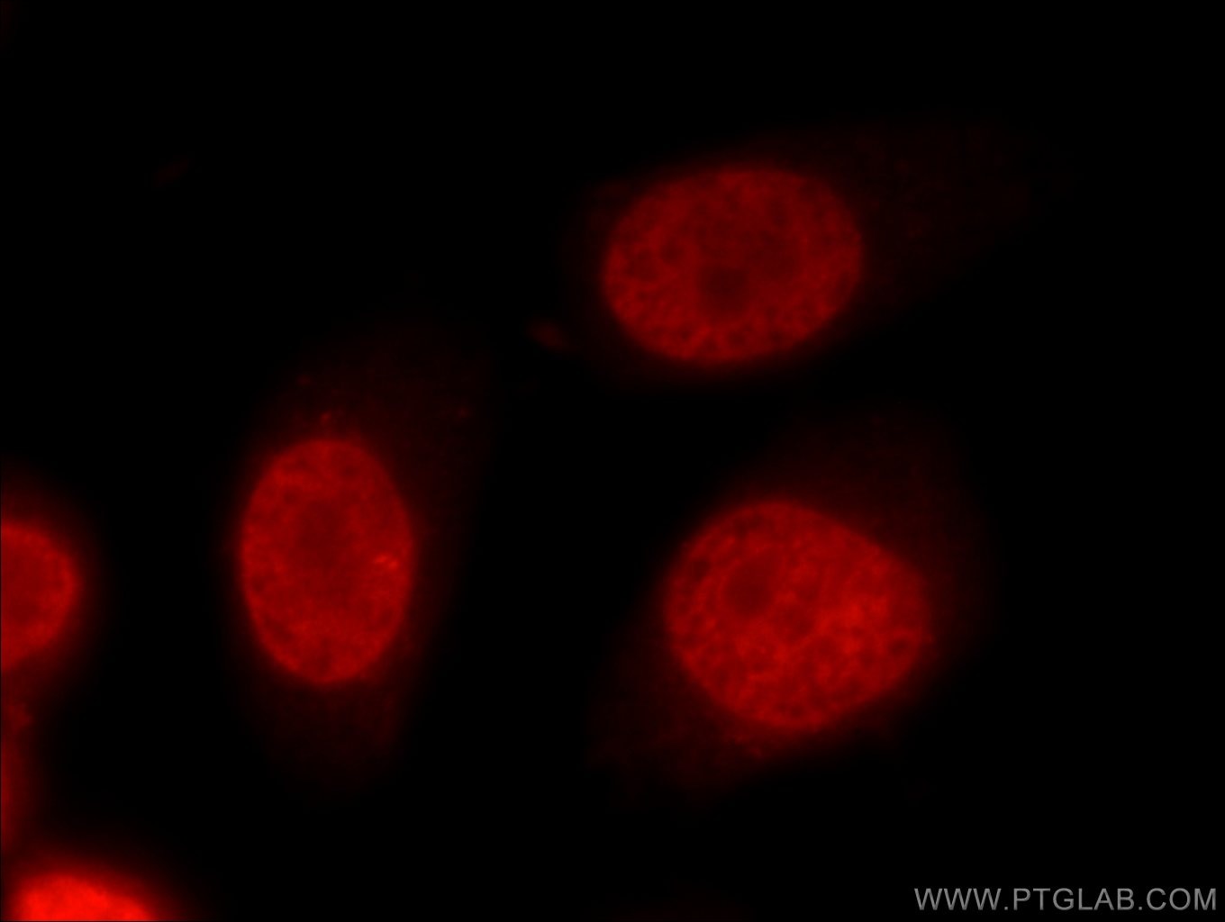 Immunofluorescence (IF) / fluorescent staining of HeLa cells using FUBP1 Polyclonal antibody (24864-1-AP)