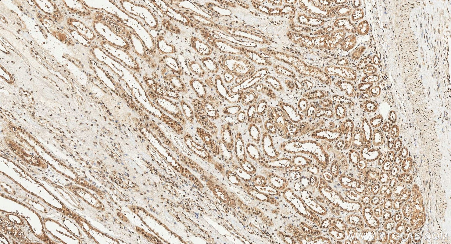 Immunohistochemistry (IHC) staining of human kidney tissue using FUBP1 Polyclonal antibody (24864-1-AP)