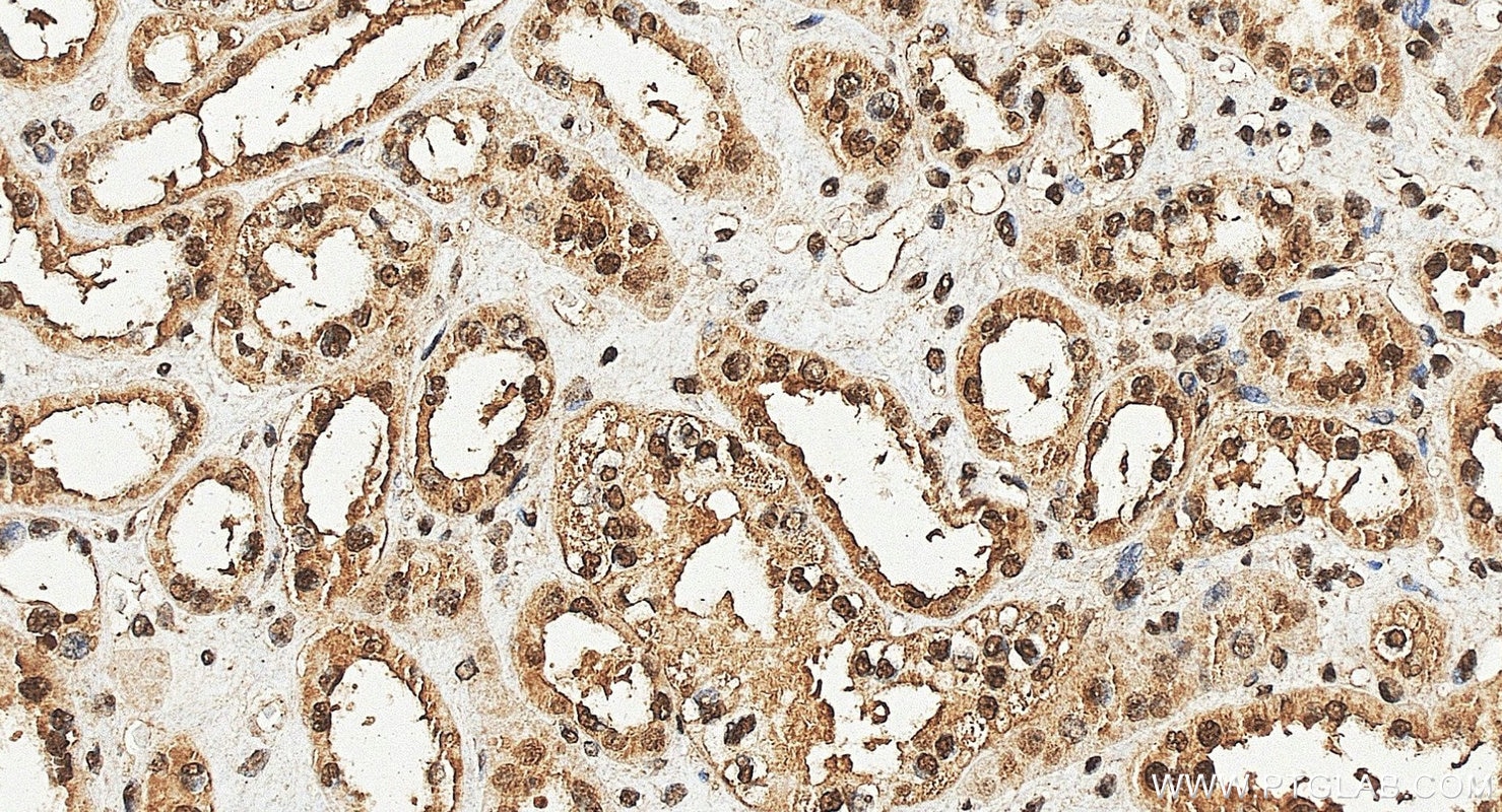 Immunohistochemistry (IHC) staining of human kidney tissue using FUBP1 Polyclonal antibody (24864-1-AP)