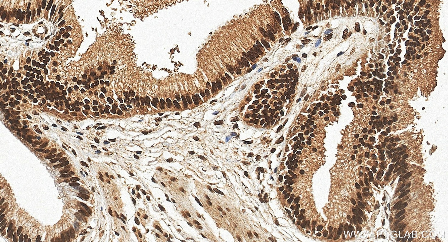 Immunohistochemistry (IHC) staining of human bladder tissue using FUBP1 Polyclonal antibody (24864-1-AP)