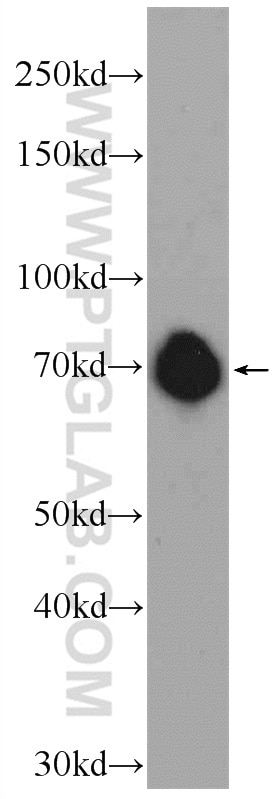 Western Blot (WB) analysis of SH-SY5Y cells using FUBP1 Polyclonal antibody (24864-1-AP)