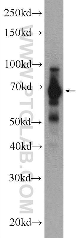 Western Blot (WB) analysis of mouse brain tissue using FUBP1 Polyclonal antibody (24864-1-AP)