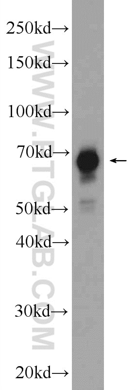 Western Blot (WB) analysis of Jurkat cells using FUBP1 Polyclonal antibody (24864-1-AP)
